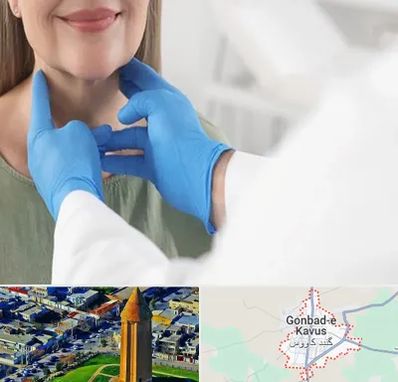 جراح سرطان گلو در گنبد کاووس