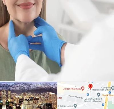 جراح سرطان گلو در جردن 