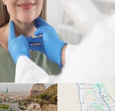 جراح سرطان گلو در فرهنگ شهر شیراز 