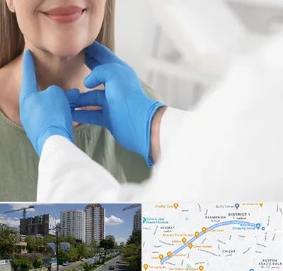 جراح سرطان گلو در اندرزگو 