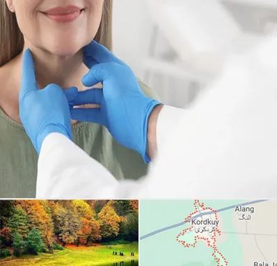 جراح سرطان گلو در کردکوی