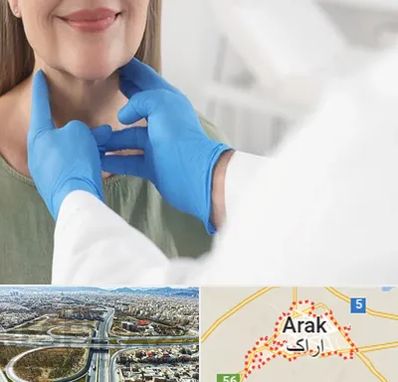 جراح سرطان گلو در اراک