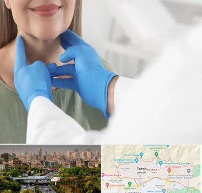 جراح سرطان گلو در منطقه 1 تهران 