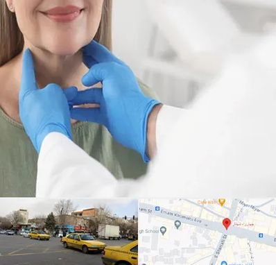 جراح سرطان گلو در شهناز تبریز