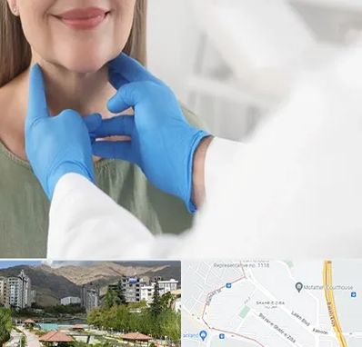 جراح سرطان گلو در شهر زیبا 