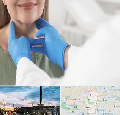 جراح سرطان گلو در منطقه 2 تهران 