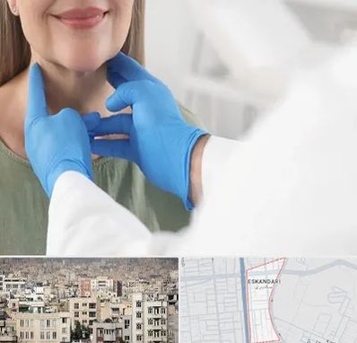 جراح سرطان گلو در اسکندری