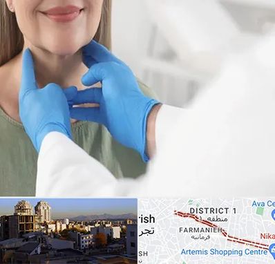 جراح سرطان گلو در فرمانیه 