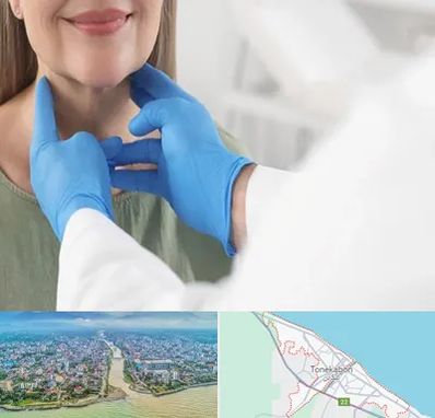 جراح سرطان گلو در تنکابن