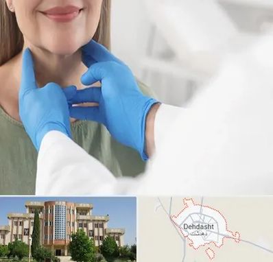 جراح سرطان گلو در دهدشت