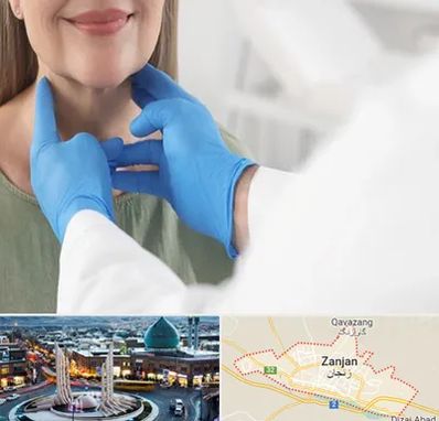 جراح سرطان گلو در زنجان