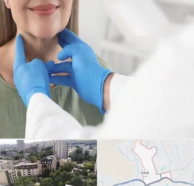 جراح سرطان گلو در اوین