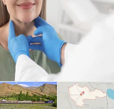 جراح سرطان گلو در خاش