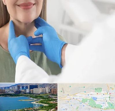 جراح سرطان گلو در منطقه 22 تهران 