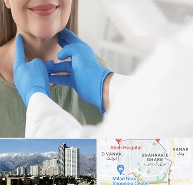 جراح سرطان گلو در شهرک غرب 
