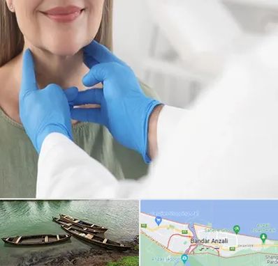 جراح سرطان گلو در بندر انزلی