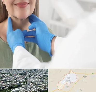 جراح سرطان گلو در شاهرود