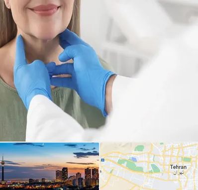 جراح سرطان گلو در غرب تهران 