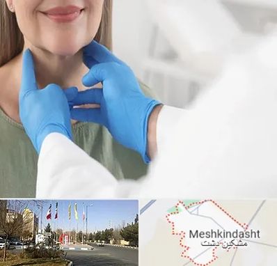 جراح سرطان گلو در مشکین دشت