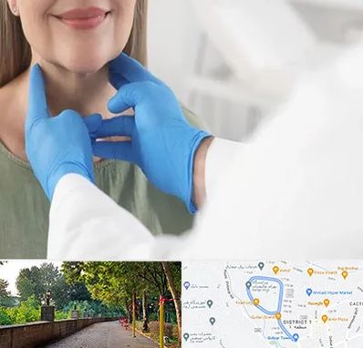 جراح سرطان گلو در فلکه گاز رشت 