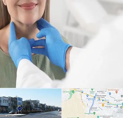 جراح سرطان گلو در شریعتی مشهد 