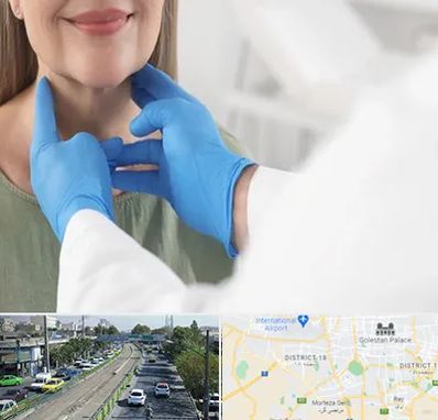 جراح سرطان گلو در جنوب تهران 