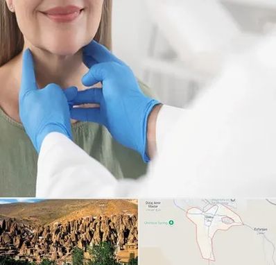 جراح سرطان گلو در اسکو