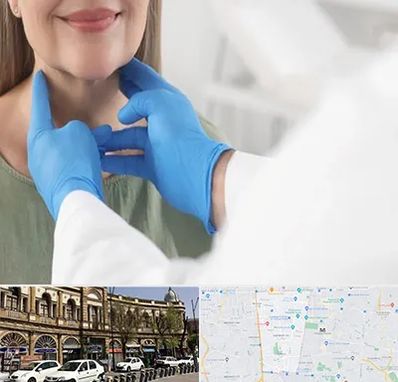 جراح سرطان گلو در منطقه 11 تهران 