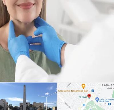 جراح سرطان گلو در فلکه گاز شیراز 