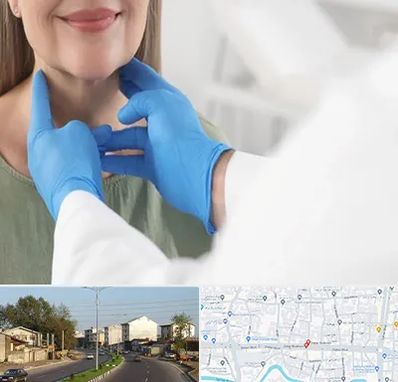 جراح سرطان گلو در ضیابری رشت 