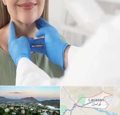 جراح سرطان گلو در لواسان