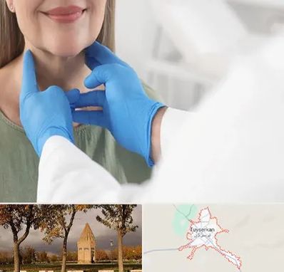 جراح سرطان گلو در تویسرکان
