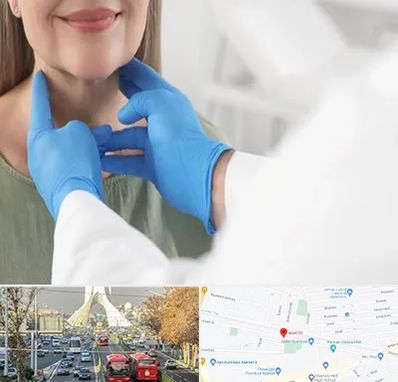 جراح سرطان گلو در خیابان آزادی 