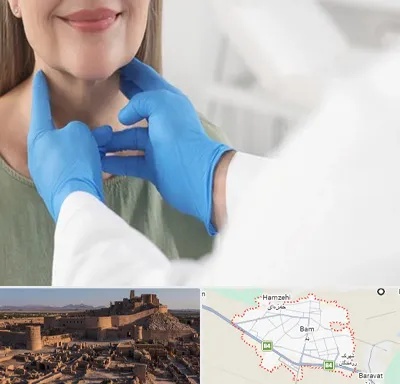 جراح سرطان گلو در بم