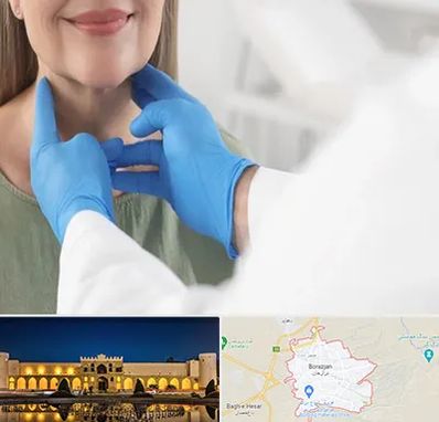 جراح سرطان گلو در برازجان
