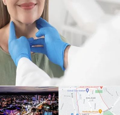 جراح سرطان گلو در گلسار رشت 