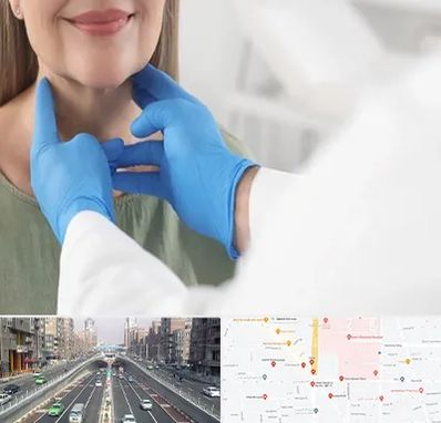 جراح سرطان گلو در توحید 