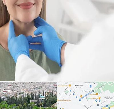 جراح سرطان گلو در محلاتی شیراز 