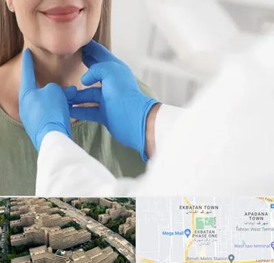 جراح سرطان گلو در اکباتان 