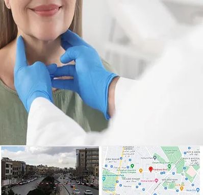 جراح سرطان گلو در بلوار فردوسی مشهد 