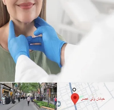 جراح سرطان گلو در ولیعصر شهریار