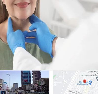 جراح سرطان گلو در چهارراه طالقانی کرج 