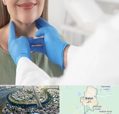 جراح سرطان گلو در بابل
