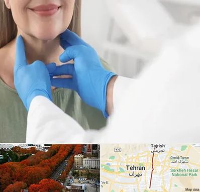 جراح سرطان گلو در ولیعصر 