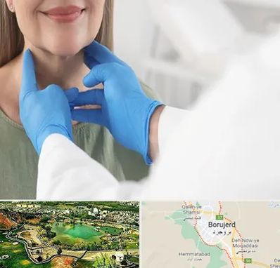 جراح سرطان گلو در بروجرد