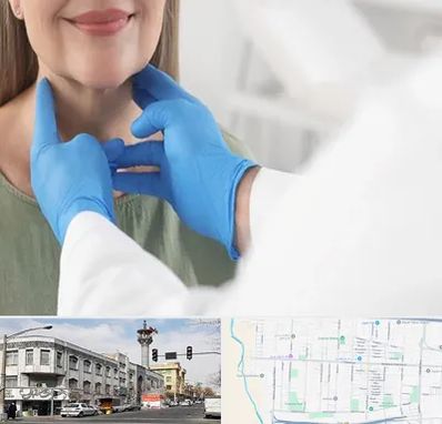 جراح سرطان گلو در 17شهریور