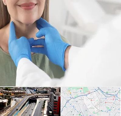 جراح سرطان گلو در ستارخان شیراز 