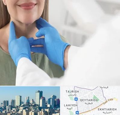 جراح سرطان گلو در قیطریه 