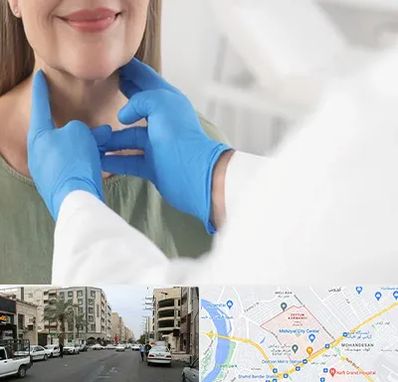 جراح سرطان گلو در زیتون کارمندی اهواز 