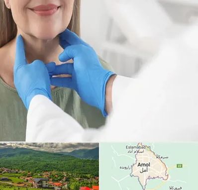 جراح سرطان گلو در آمل